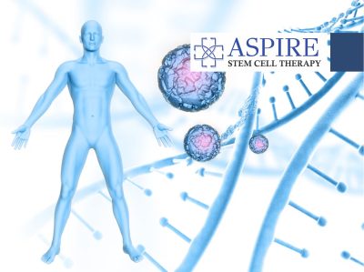 stemcell therapy